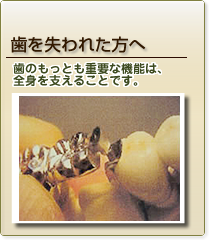 歯を失われた方へ
